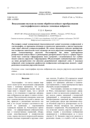 Визуализация опухоли на основе обработки вейвлет-преобразования эластографического сигнала с помощью нейросети