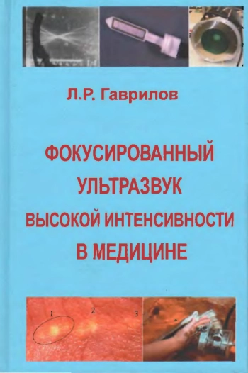 Фокусированный ультразвук высокой интенсивности в медицине