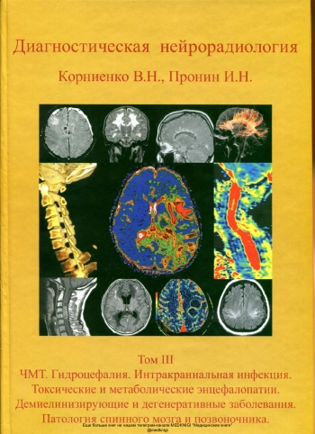 Диагностическая нейрорадиология. Том 3