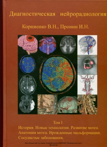 Диагностическая нейрорадиология. Том 1