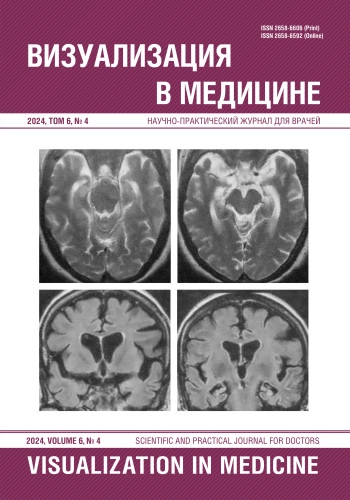ВИЗУАЛИЗАЦИЯ В МЕДИЦИНЕ